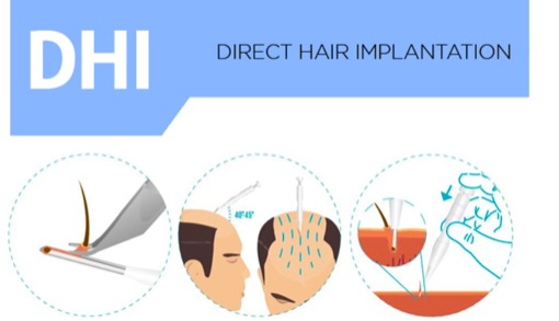 resme alternatif yazı